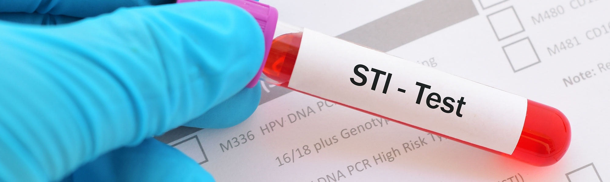 STI blood test